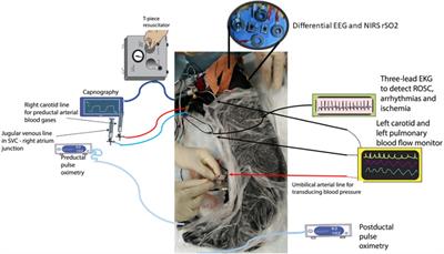 Technical feasibility of multimodal imaging in neonatal hypoxic-ischemic encephalopathy from an ovine model to a human case series